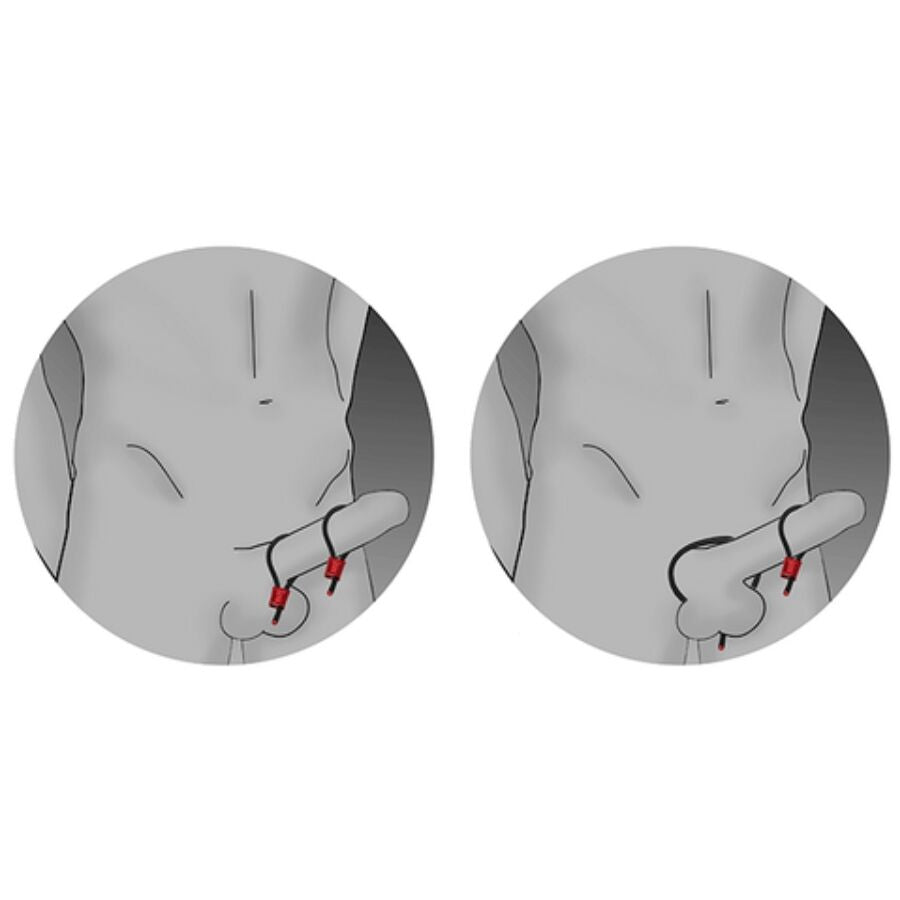 ELECTRASTIM - PRESTIGE ELECTRA LOOPS SÄÄDETTÄVÄT PENSIRENKAAT PUNAISET